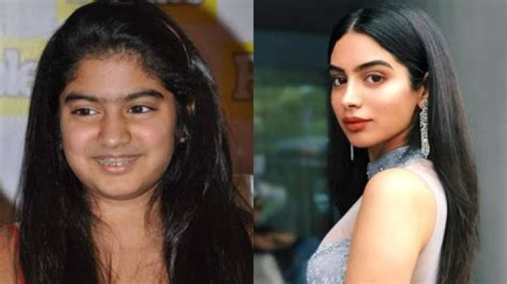 Janhvi Kapoor's Plastic Surgery Journey